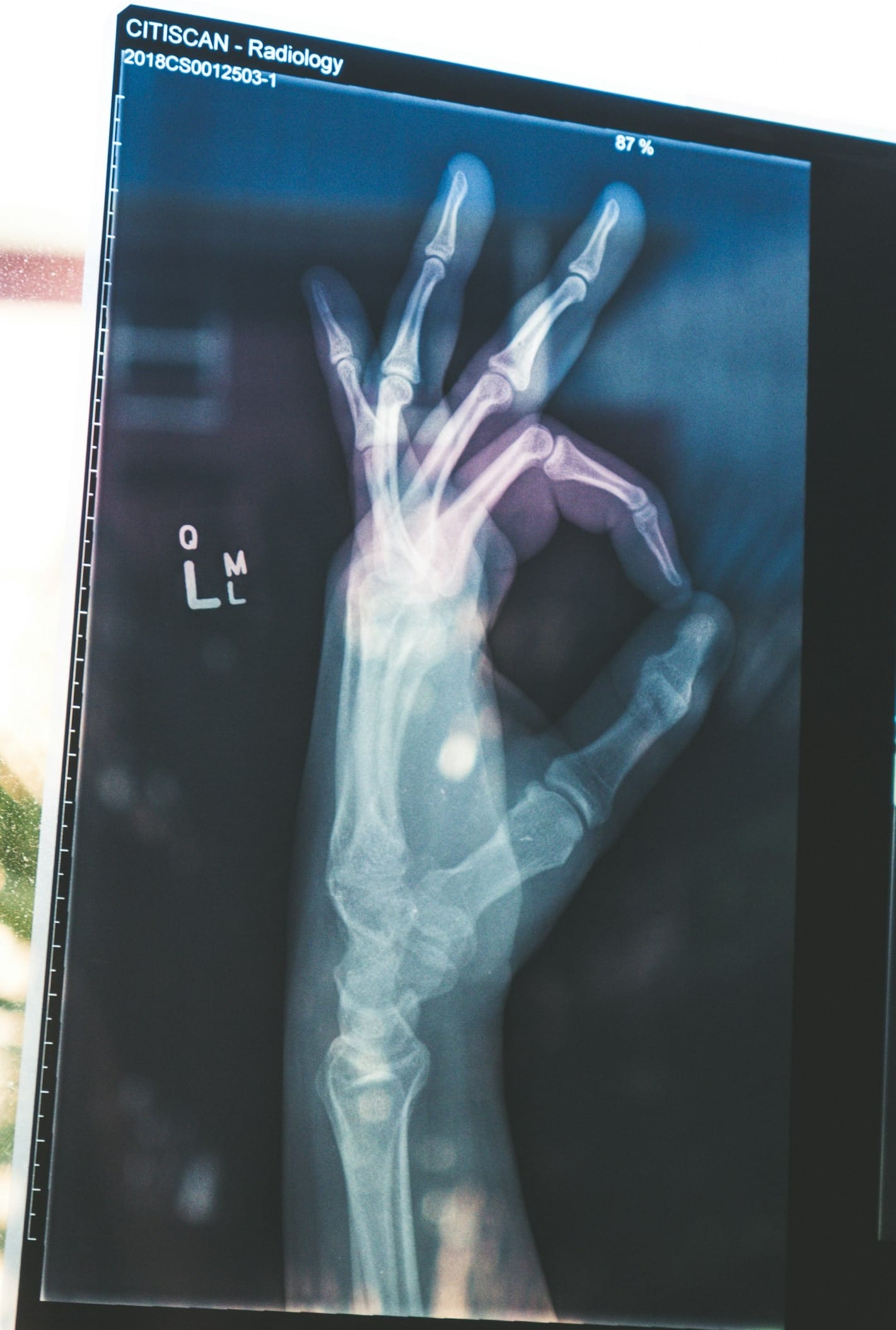 citiscan result hand ok